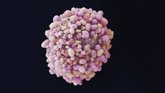 Foto: Identifican una molécula clave responsable del mal pronóstico del cáncer de mama triple negativo