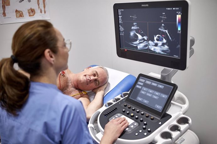 Dispositivo de ultrasonido de cardiología EPIQ CVx