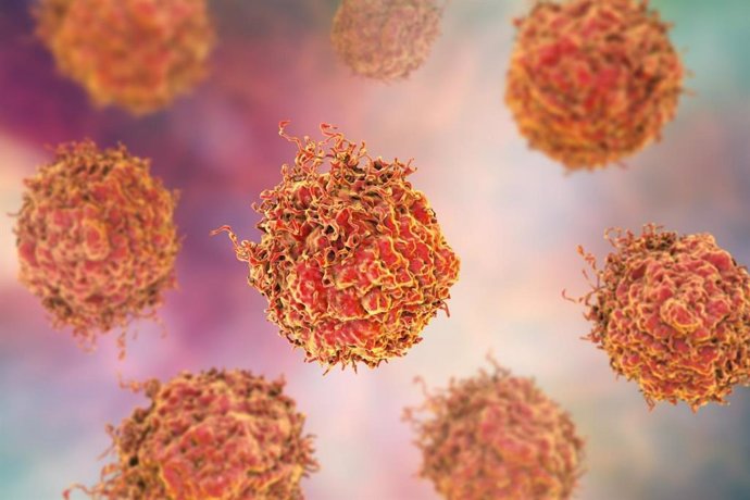 Nuevos conocimientos sobre cómo el cáncer de próstata causa tumores secundarios