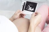 Foto: Entre el 50 y el 70% de los embriones tienen una anomalía cromosómica que provoca infertilidad y abortos espontáneos