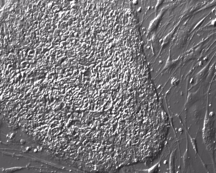 Las células madre diseñadas para eludir el sistema inmunológico son prometedoras
