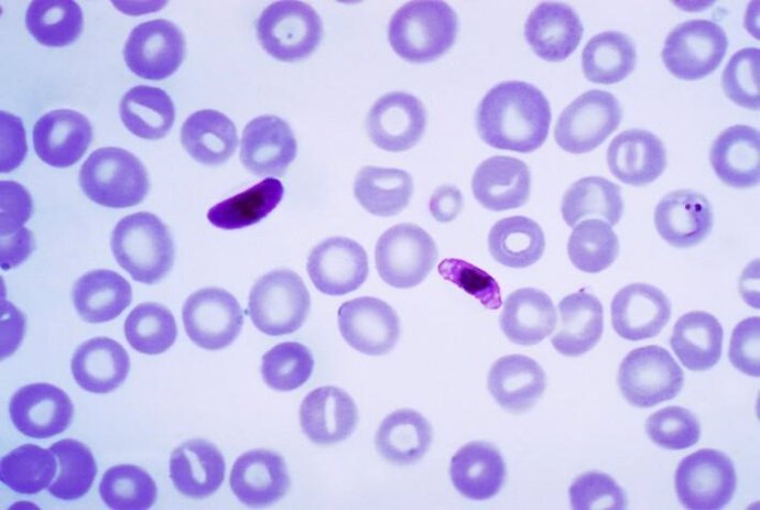 Plasmodium falciparum, un parásito que causa la malaria cerebral.