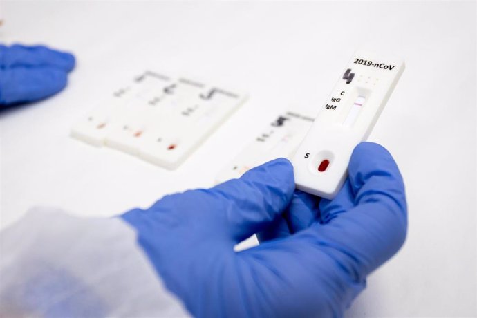 Aragón detecta 456 nuevos casos procedentes de 4.309 PCR.