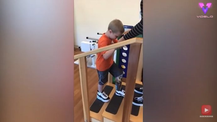 Este niño vuelve a caminar después de que un accidente con la cortacésped le dejara con parte de una pierna amputada