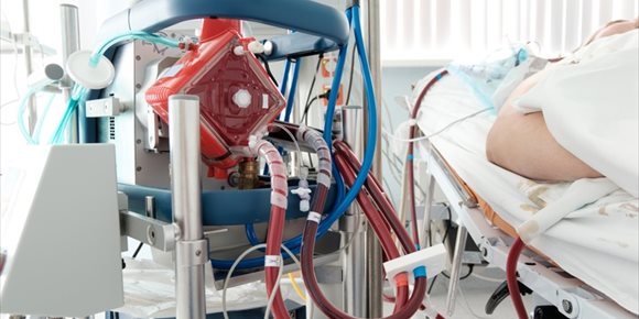 4. Así ayuda el sistema ECMO a sobrevivir a pacientes críticos con COVID-19