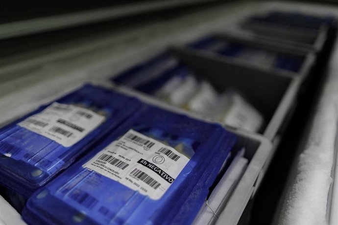 Imagen de archivo de plasma congelado.