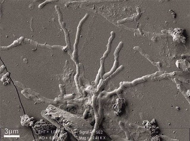 Neuronas vitrificadas de víctima de la erupción del Vesubio hace 2.000 años