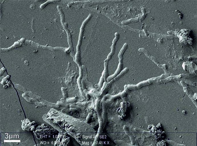Neuronas vitrificadas de una víctima del Vesubio hace 2.000 años