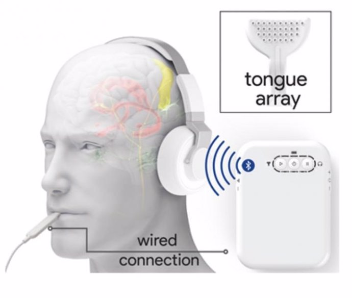 Un esquema que muestra el dispositivo de neuromodulación bimodal. Los auriculares inalámbricos emitían sonidos, mientras que una pequeña guía de electrodos estimulaba la lengua con diferentes patrones