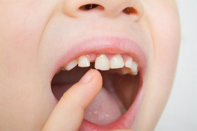 Los dentistas piden cuidar la alimentación y la higiene bucodental para prevenir