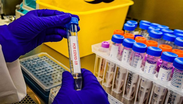 Realización de un test PCR