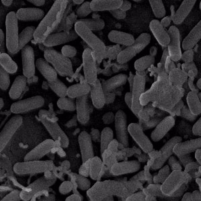 Imagen microscópica de bacterias del género Listeria