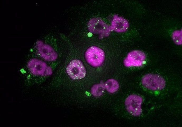 Células tumorales de adenocarcinoma de páncreas que muestran signos de daño en el ADN del núcleo (puntos blancos) y de micronúcleos (en verde), después de un tratamiento con taxol seguido de inhibidores de CDK4/6