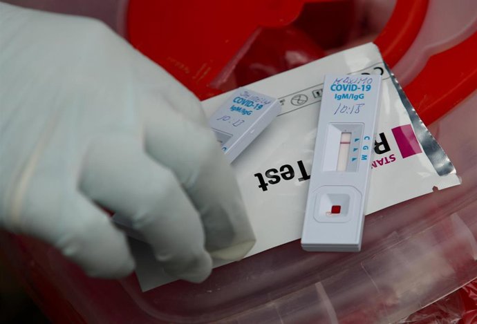 Resultados de pruebas rápidas de coronavirus en Lima, Perú.