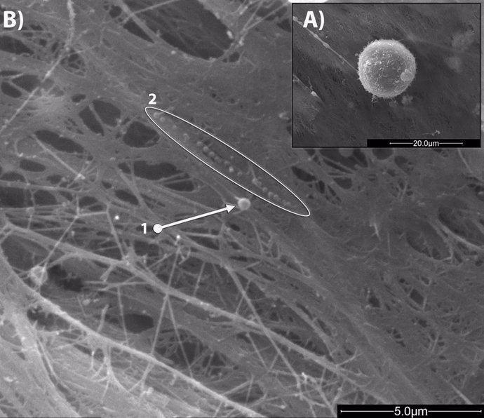 Imágenes SEM de unas célula madres mesenquimales en cultivo. B) 1. Imagen de microvesícula (diámetro 460 nm) y 2. Conjunto de exosomas (diámetro medio 140nm) secretados por las células MSCs: