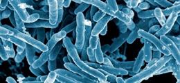 Micrografía electrónica de Mycobacterium tuberculosis, bacteria causante de la enfermedad