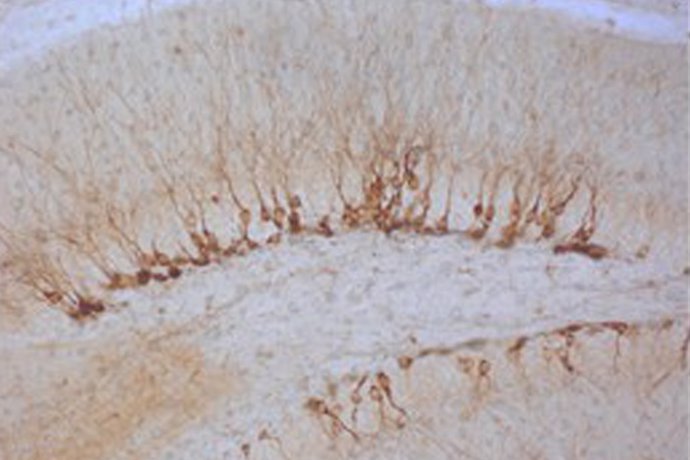 Neuronas inmaduras en el giro dentado de un ratón sobrexpresando los factores de Yamanaka.