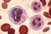 Foto: Investigadores encuentran un nuevo enfoque contra la leucemia