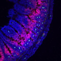 A lo largo del borde del intestino delgado, las neuronas (verdes) aparecen muy cerca de la molécula inflamatoria Nlrp6 (rosa).