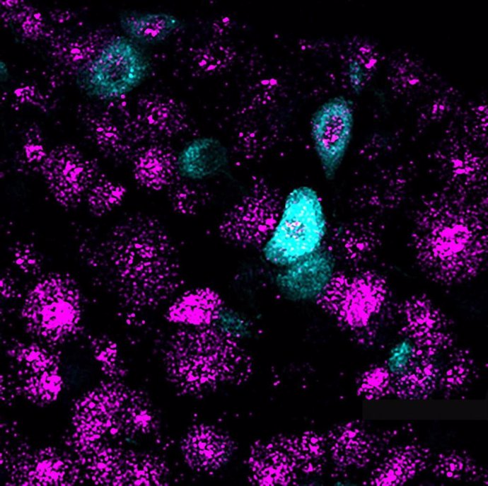 Una foto de DRG de ratón de color púrpura. El gen PIEZO2 es de color azul claro.