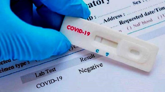 La única forma de poner freno a la pandemia es hacer test  masivos