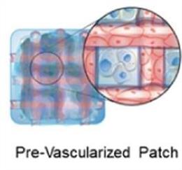 Un parche de células cardíacas combina una red de vasos sanguíneos (rojo) con células estromales cardíacas humanas (azul) en una matriz de fibrina tridimensional, como se ve en la interpretación de este artista.