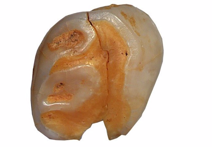 Presumiblemente, un niño de Neandertal perdió este diente hace 40.000 a 70.000 años cuando le salieron los dientes permanentes.
