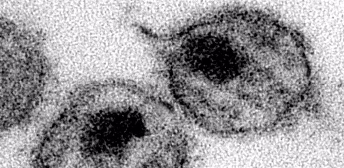 ?Virus del VIH (imagen de A. Harrison y P. Feorino, del USCDCP, vía PIxnio).