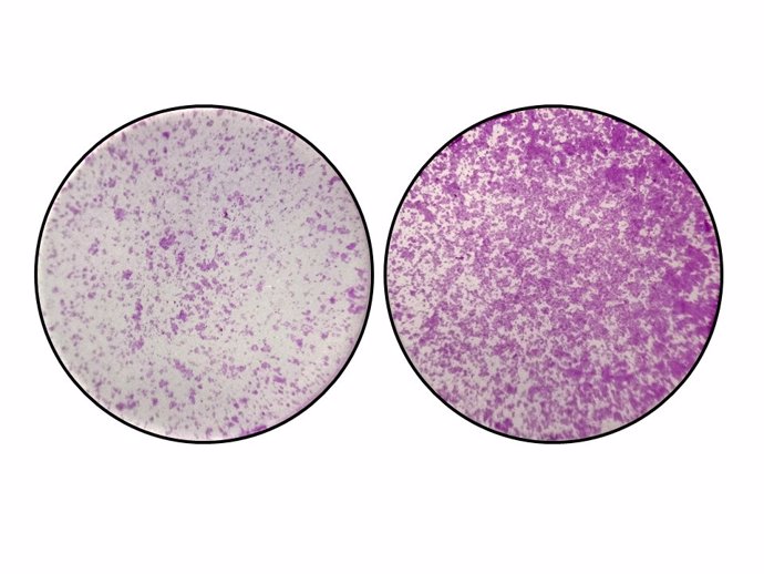 En la izquierda, se observan células del colon con niveles normales de TYW2 y la pieza Y. En la derecha, cuando sucede la perdida de TYW2 y el nucleótido Y, las células del cáncer de colon empiezan a migrar de forma descontrolada