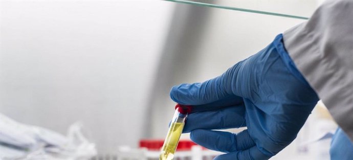 La OMS aprueba nuevas pruebas rápidas de antígenos para la COVID-19 que se están distribuyendo a nivel mundial.