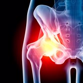 Foto: La importancia del dolor en el tratamiento de la artrosis de cadera