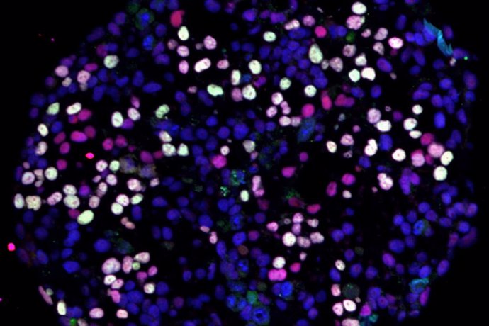 Células madre pluripotentes humanas (azul) convirtiéndose en células germinales humanas (rosa y blanco).