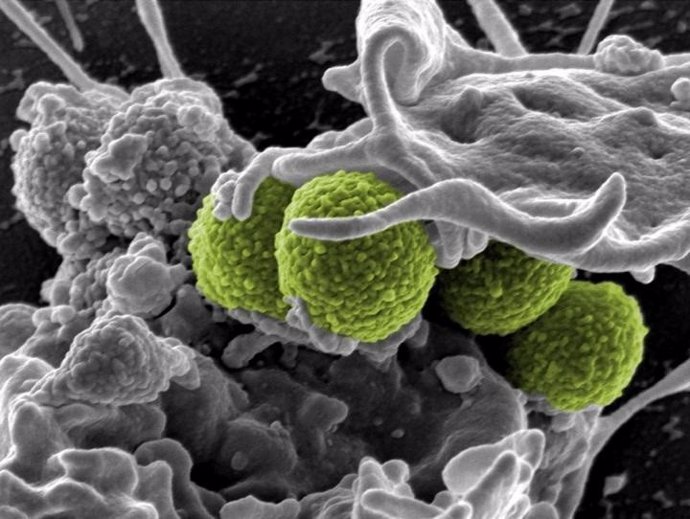 Staphylococcus aureus (en verde) interactúa con una célula inmune,