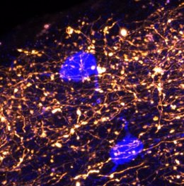 En la capa superior del neocórtex, la información relacionada con la memoria es transmitida por las sinapsis del tálamo (naranja), que a su vez están controladas por las neuronas locales "guardianas" (azul).