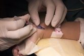 Foto: La gasometría arterial, una prueba de gases en la sangre