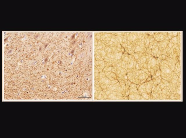 Izquierda: corte de cerebelo, con factor de aumento 40x, obtenido con microscopía electrónica (Dr. E. Zunarelli, Hospital Universitario de Módena); derecha: sección de una simulación cosmológica, que se extiende 300 millones de años luz a cada lado