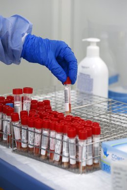 Tubos de pruebas PCR para la detección del COVID-19 en el "Autocovid" del Hospital Universitario Central de Asturias (HUCA), Oviedo (Asturias), a 11 de noviembre de 2020. 