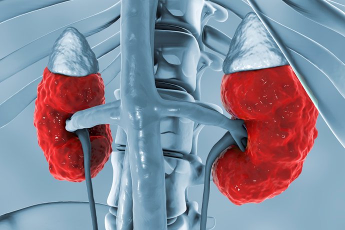 Enfermedad renal crónica