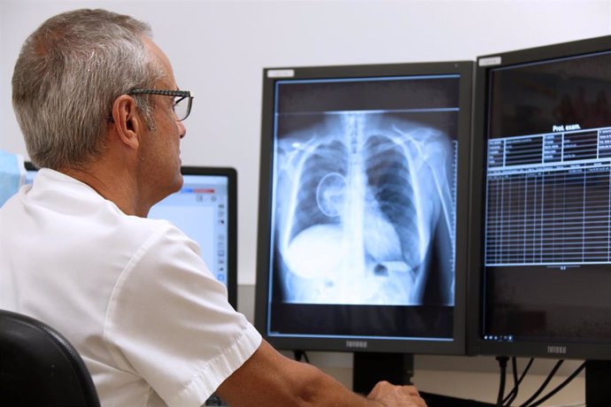 Investigadores españoles lanzan una prueba piloto paa identificar nódulos indicadores de cánceres pulmonares