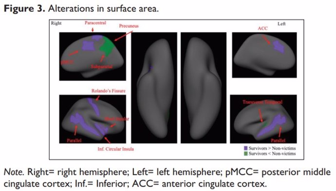 Alteraciones en el área/superficie cerebral.