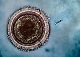 Foto: Las anomalías cromosómicas embrionarias se producen antes de la primera división celular del óvulo recién fecundado