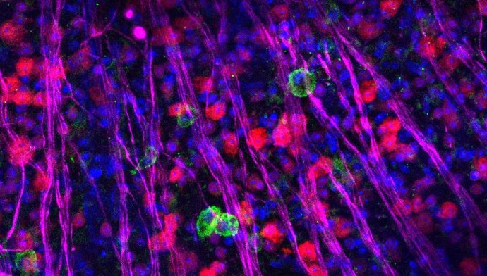 Retina degenerativa trasplantada con células madre que expresan Ccr5 y Cxcr6. El verde son las células trasplantadas, el rojo y el magenta son las neuronas de la retina.