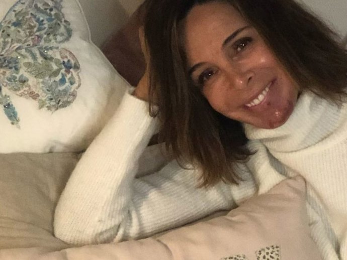 Lydia Bosch sonríe a la vida y lucha con positividad contra un cáncer de piel