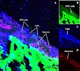 Foto: Construyen la primera retina artificial con biomaterial de seda para tratar una degeneración de la mácula