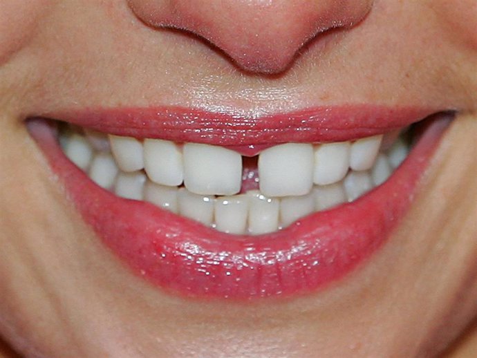 The teeth of Supermodel Jess Hart are seen as she smiles at the Myer marquee during Crown Oaks Day at Flemington Racecourse on November 4, 2010 in Melbourne, Australia.