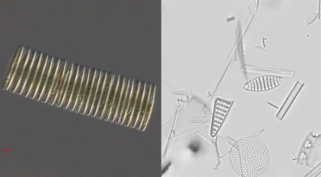 Imagen de diatomeas vivas