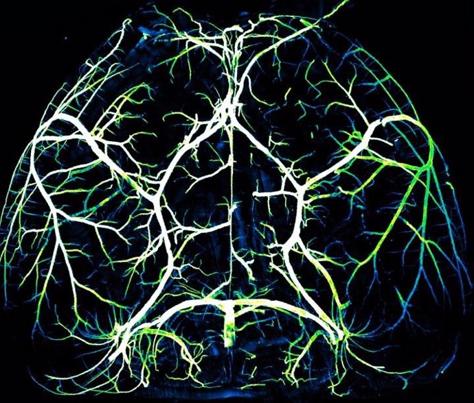 Arterias del cerebro.