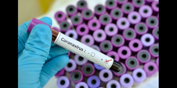 8. La FDA aprueba el primer test de antígenos casero que no necesita receta médica