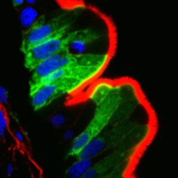 Localización del gen de Smoothelin (verde más brillante) en la red terminal debajo de las microvellosidades del intestino (rojo).