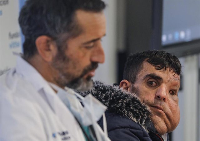  Ali Amnad Rifi, un paciente de 30 años procedente de Marruecos, al que el doctor Cavadas ha practicado tres cirugías para extirparle una tumoración gigante que hacía que su cara llegase hasta por debajo de la cintura.